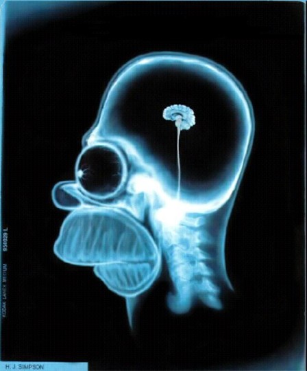 homer_brain